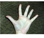 ASL Five Front
