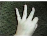 ASL Nine Back