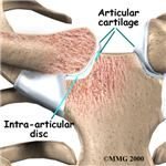 Direct Bone Attachment