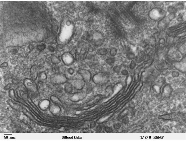 What is the function of the Golgi vesicles?