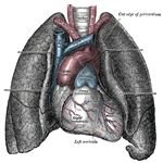 Diet After Heart Surgery