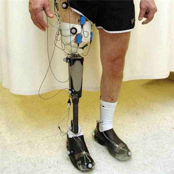 Expanded prosthetics and organ engineering. Types of prosthetics. Головной передатчик Advanced Bionics.