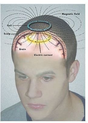 brain electromagnetism