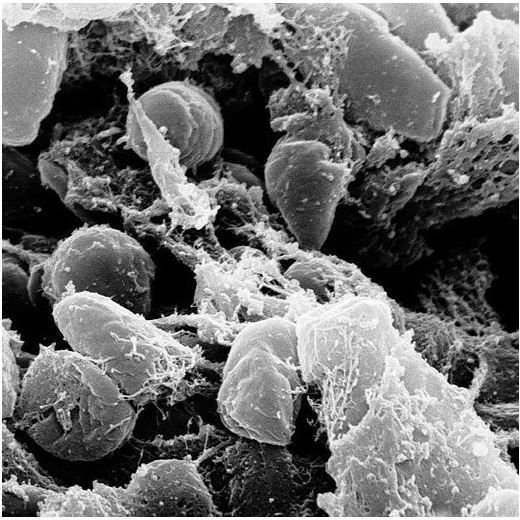 How Does Yersinia Pestis Attack and Spread? Undertanding How Yersinia Pestis Bacteria Work