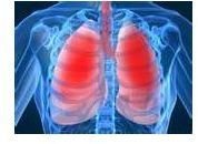 General Facts About Lung Cancer: An Overview of the Disease for the Average Person