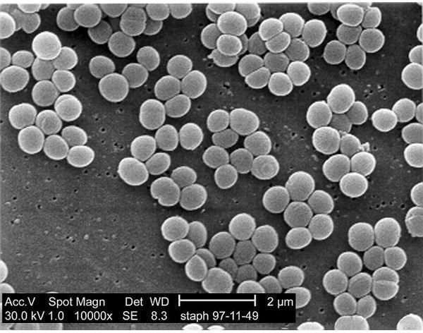 Staphylococcus Aureus Cluster