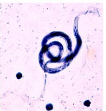 Things to Know about the Filarial Worm: Bruglia malayi