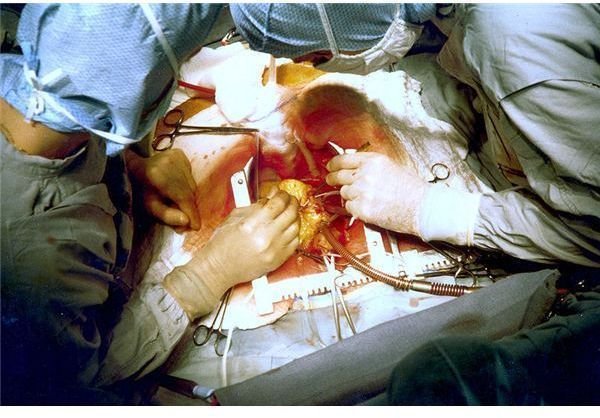 First Open Heart Surgery: Early Heart Surgery to Help Congenital Heart Disorders and Narrowed Heart Valves