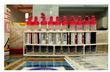 Learn What Test are Included in the CMP Blood Test
