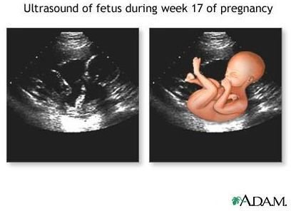 How Ultrasounds Work - Learn More About this Medical Imaging Technology and the Many Uses of Ultrasound