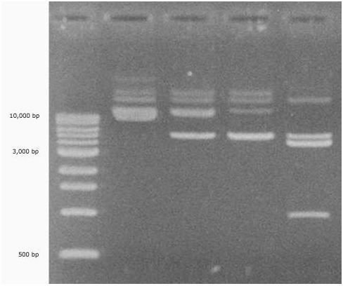 The Invention of Electrophoresis