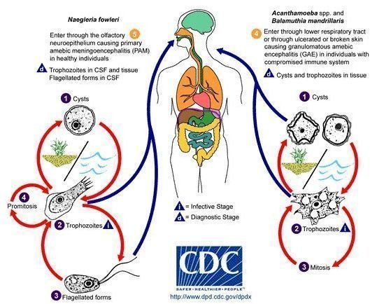 Free-living amebic infections