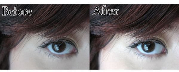 Before and After White Eye Correction