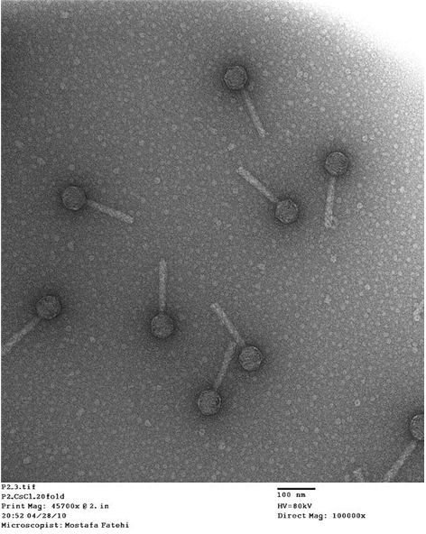 Various Life Cycles of a Bacteriophage