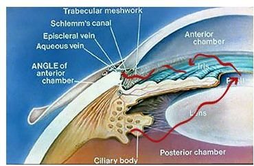 Doctors Answer the Question, How is Glaucoma Inherited?