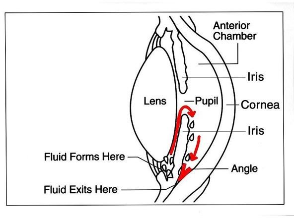 Acute Angle Closure Glaucoma