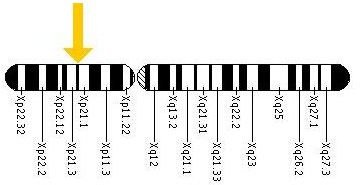 Duchenne Muscular Dystrophy: symptoms, genetic basis, and inheritance