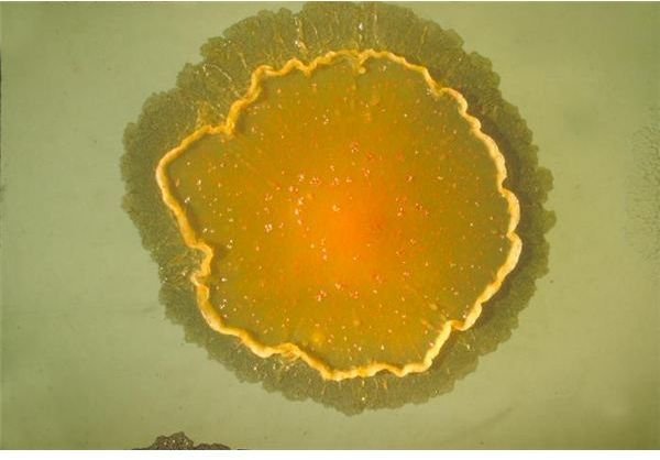 Mycobacterium balnei (CDC-PHIL -3111) lores