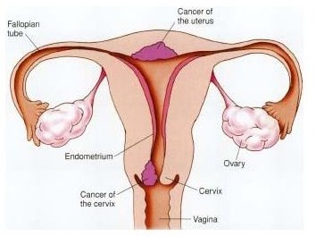 A Guide to Cervix Cancer Alternative Treatments
