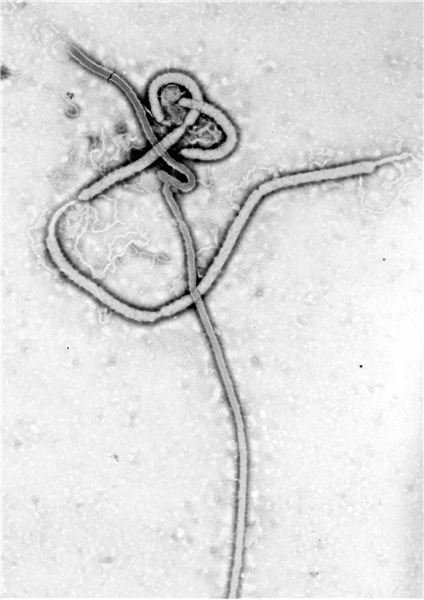 Fruit Bats as Reservoirs of Ebola Virus: The Search for the Source of the Ebola Virus