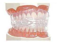 TMJ mouth guard