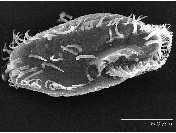 learn-the-characteristics-types-and-ecological-importance-of-protozoa