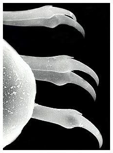 SEM of the chaetae (bristles) of a polychaete worm