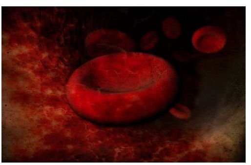 How to Increase Platelet Count With Healthy Foods: Reduce the Fatigue of Thrombocytopenia With Dietary Changes