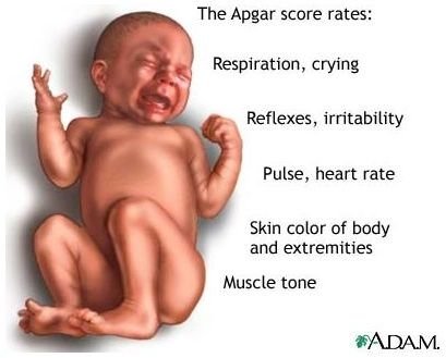 What Does a Low Apgar Score Mean in a Newborn and What Causes It?