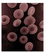 Find the Right Foods to Treat Anemia