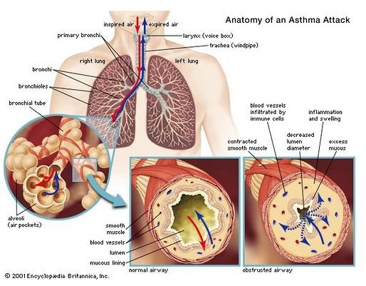 Supraventricular Tachycardia and Asthma