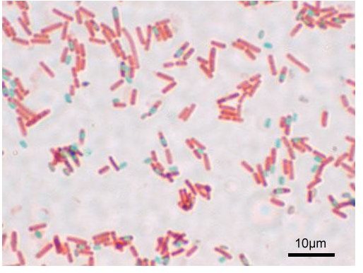 Information on Bacterial Endospore