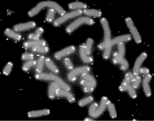 Telomere on Chromosomes