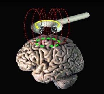 Effect of magnetic field on human brain