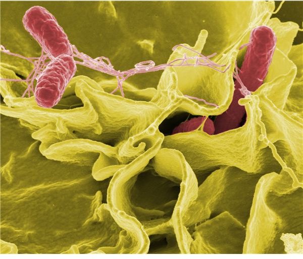 What are Salmonella Bacteria Characteristics? What is the Size of Salmonella Bacteria and Other Salmonella Questions?