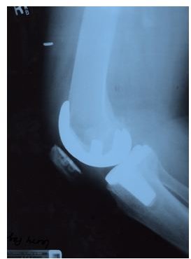 Prolotherapy Training Today: Learning the Skills to Become a Prolotherapist