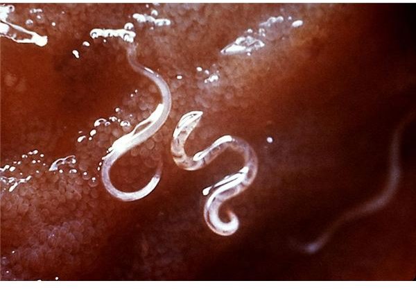 Intestinal Parasites in Humans.  A Close-up Look at Human Intestinal Parasites