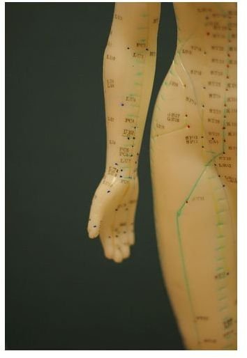 How Does Acupuncture Work and What Can It Be Used For?