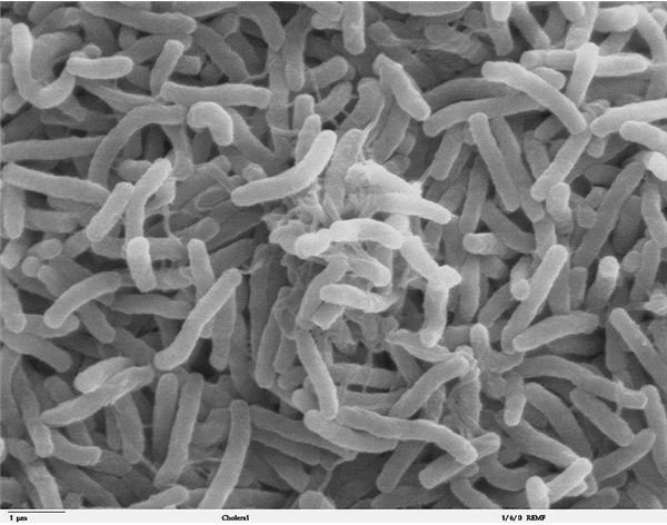 What is Cholera? How Vibrio Cholerae Causes Disease