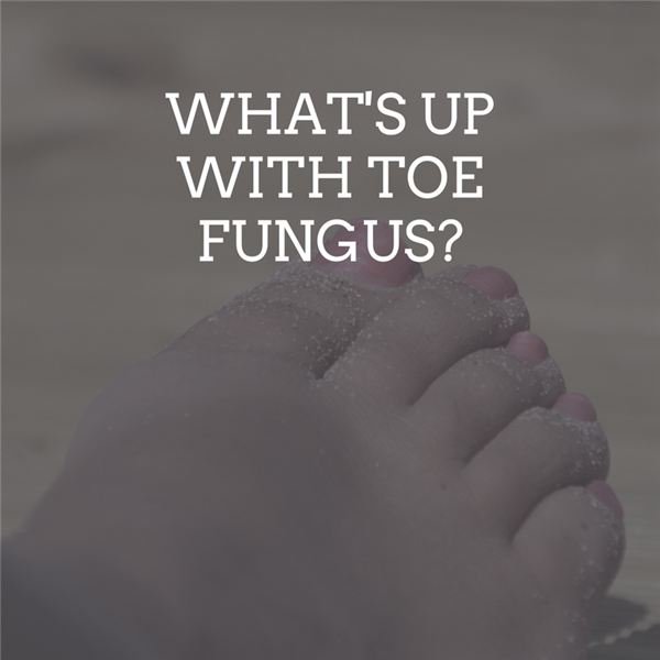 Toenail Fungus: What Causes It and How to Get Rid of It