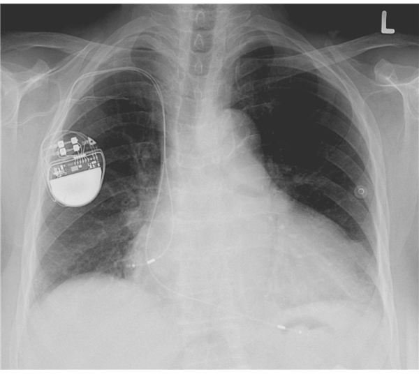 What is Bioelectronics?