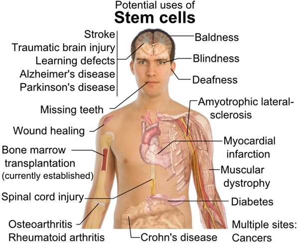 Treatment, Cures, & Research into Stem Cells