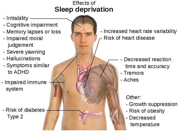 Sleep Deprivation