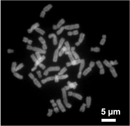 Chromosomal Abnormalities: Reciprocal and Robertsonian Translocations