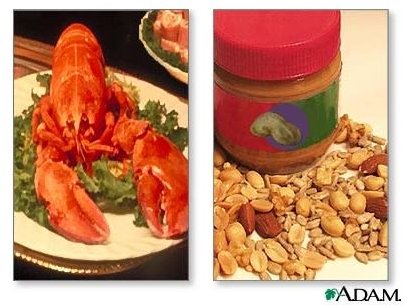 Most Common Food Allergies in Adults and Children