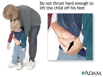 Learn How to do the Heimlich Maneuver on Children & Adults