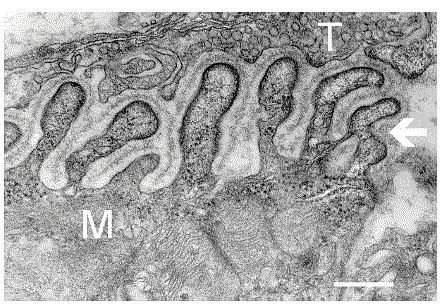 Neuromuscular Junction