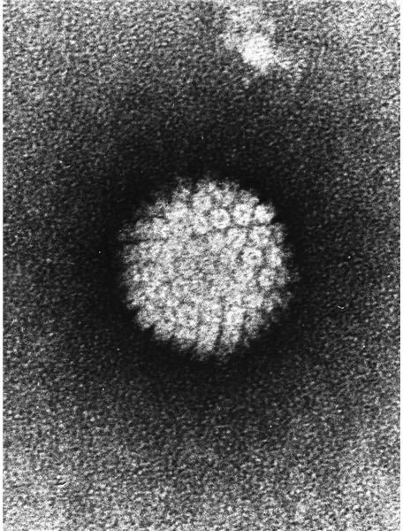 Papilloma Virus (HPV) Electron micrograph of a negatively stained human papilloma virus (HBV) which occurs in human warts - image released into the public domain by the National Institutes of Health