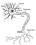 Nerve Damage from Surgery