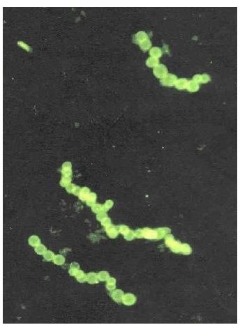 Different Ways in Which Bacteria Grow